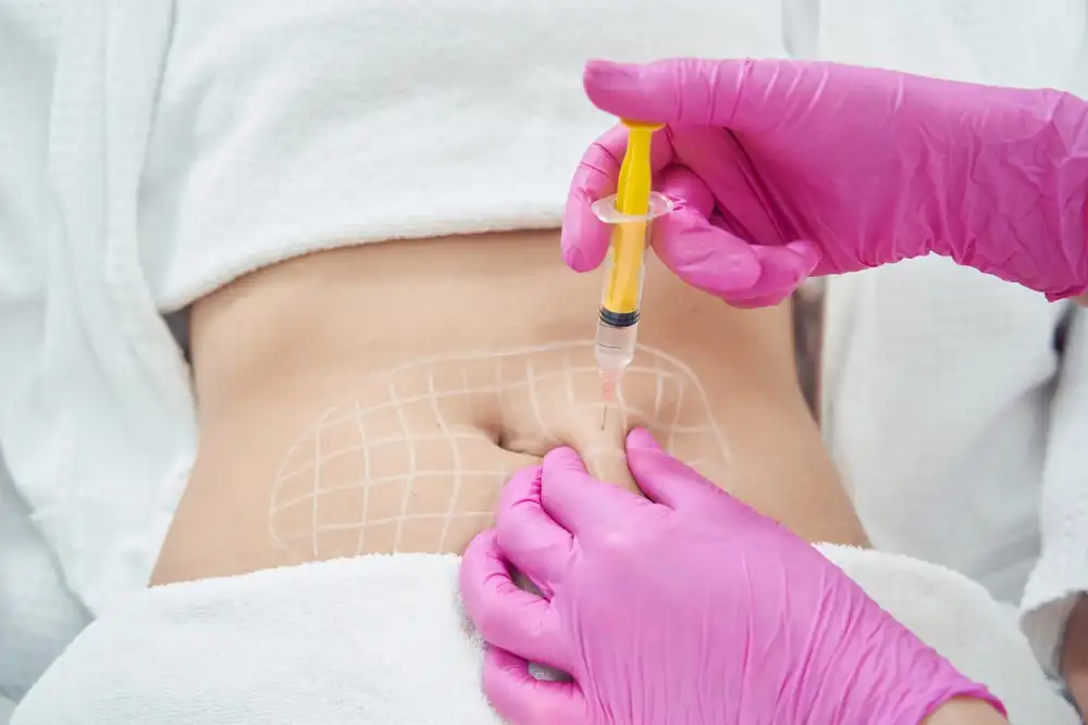 lipolysis body