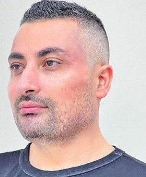 filler face after